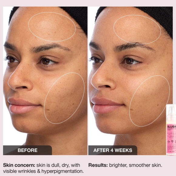 Slushy - INNBEAUTY Project
Serum Moisturizer 2N1
1.7 oz BRAND NEW - Picture 6 of 16